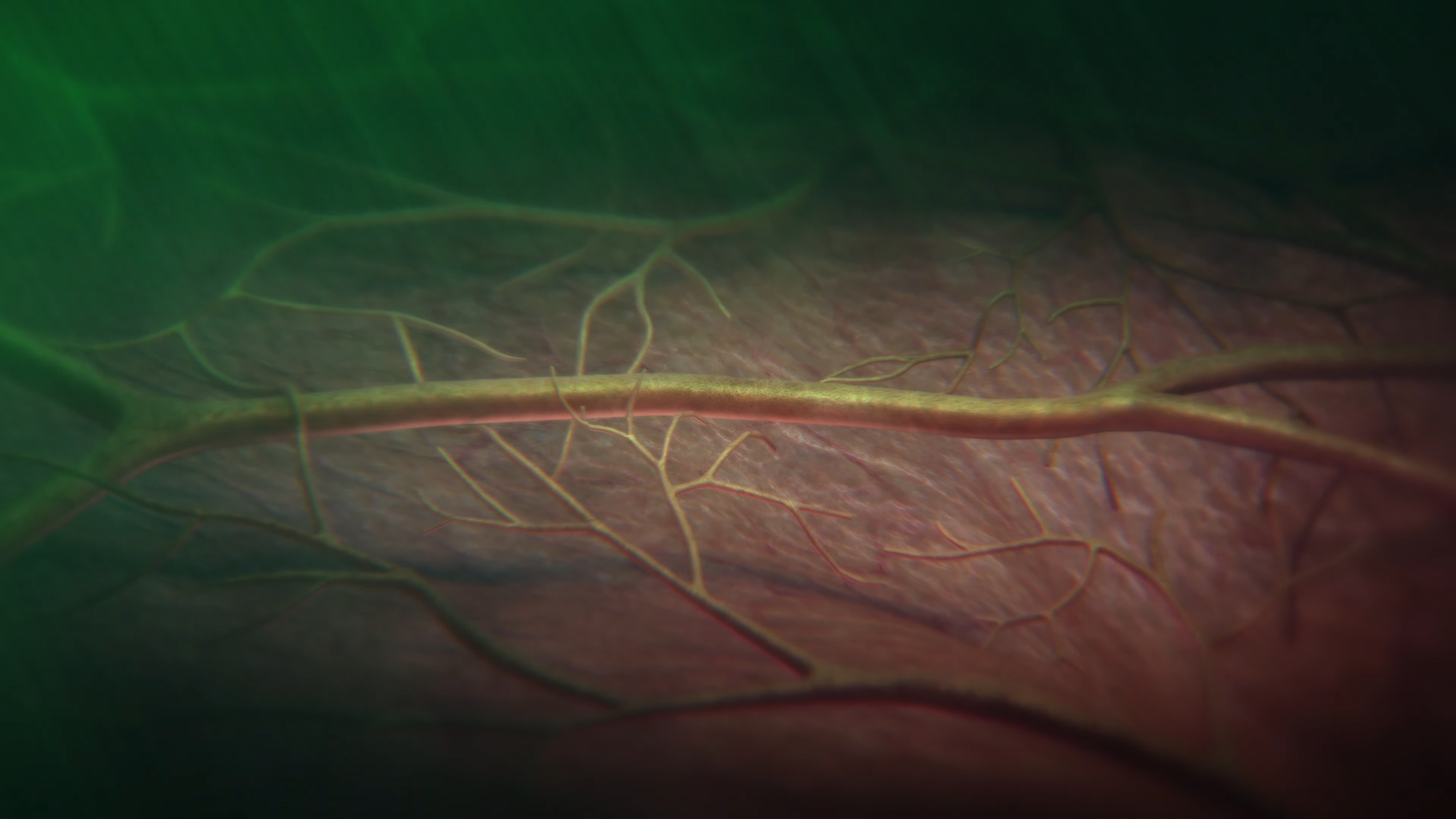 ویژگی فشار خون بالا اپل واچ