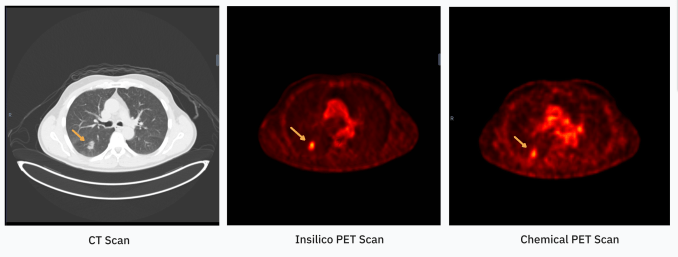 تصویربرداری PET با AI