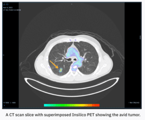 تحول در تصویربرداری PET با AI: راهکار RADiCAIT